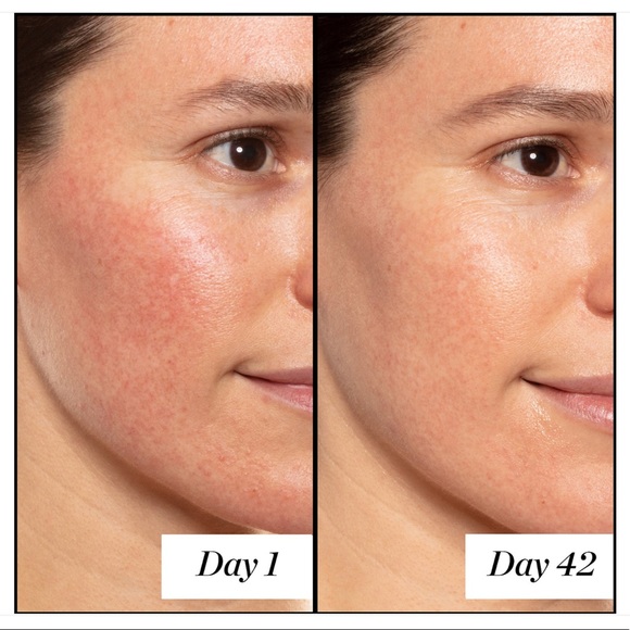 Sunday Riley A+ High-Dose Retinoid Serums - Picture 6 of 8